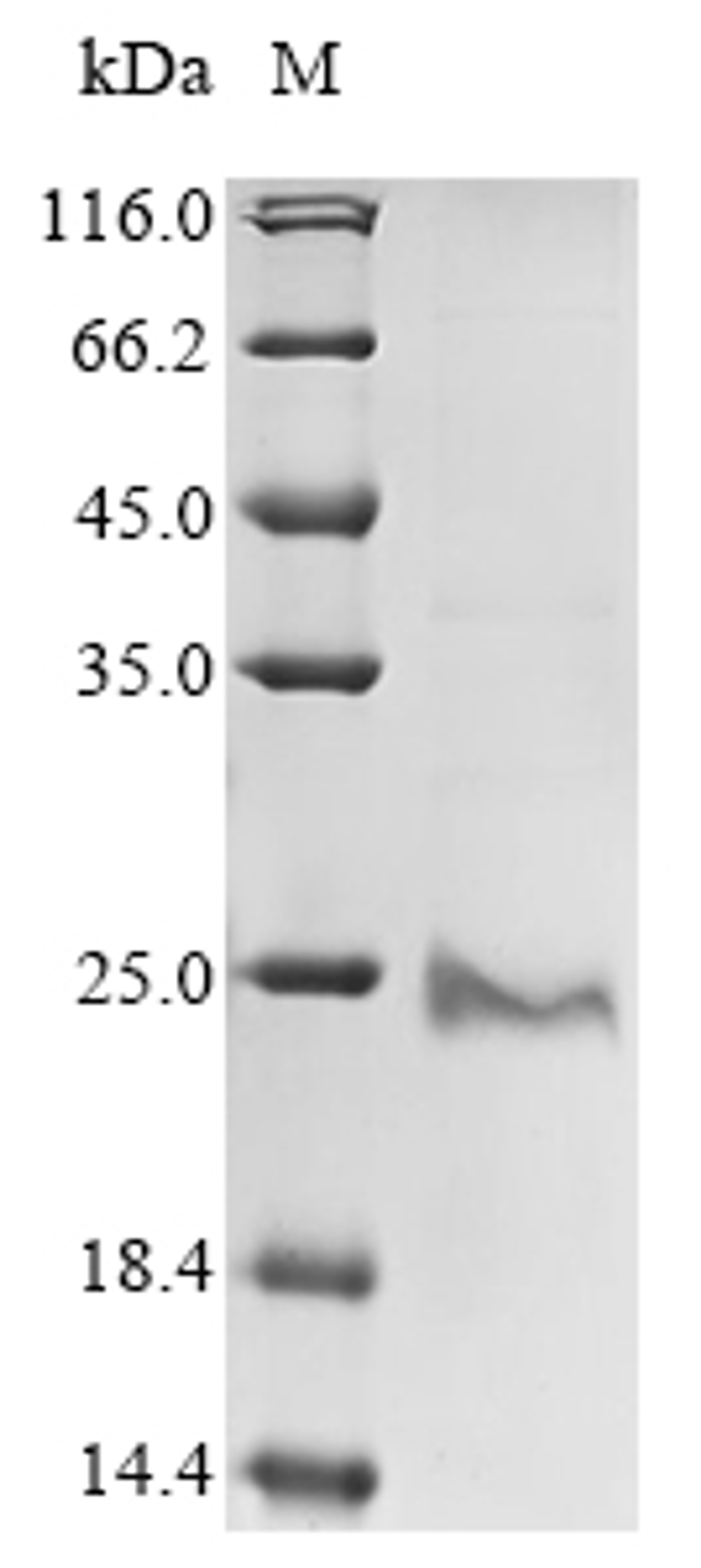 (Tris-Glycine gel) Discontinuous SDS-PAGE (reduced) with 5% enrichment gel and 15% separation gel.