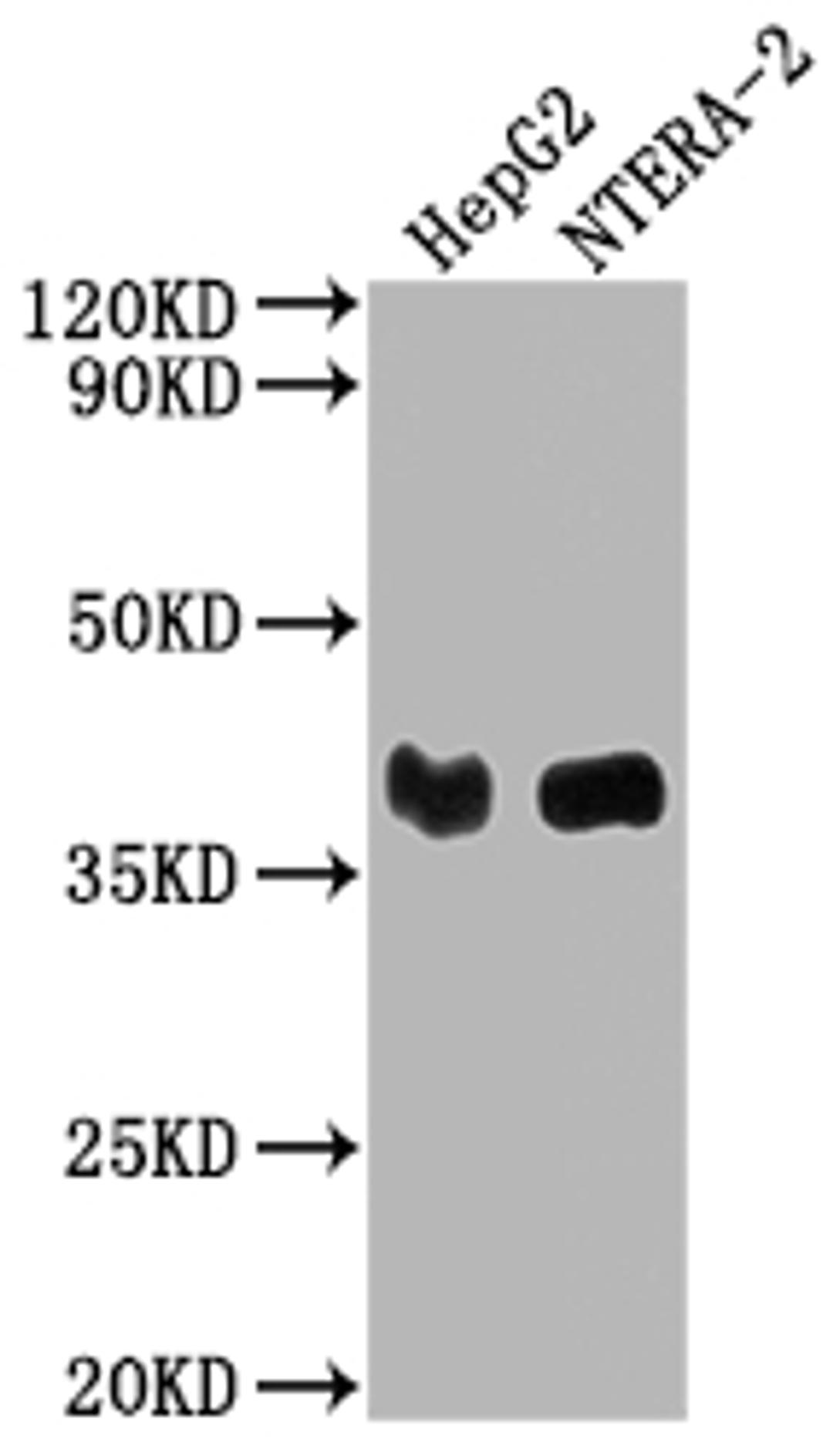 Western Blot. Positive WB detected in: HepG2 whole cell lysate, NTERA-2 whole cell lysate. All lanes: LCMT1 antibody at 1:2000. Secondary. Goat polyclonal to rabbit IgG at 1/50000 dilution. Predicted band size: 39, 42, 33 kDa. Observed band size: 39 kDa. 