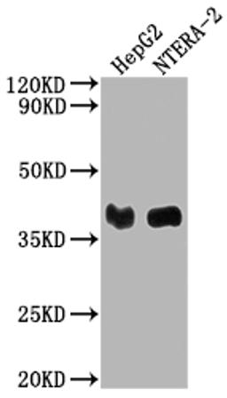 Western Blot. Positive WB detected in: HepG2 whole cell lysate, NTERA-2 whole cell lysate. All lanes: LCMT1 antibody at 1:2000. Secondary. Goat polyclonal to rabbit IgG at 1/50000 dilution. Predicted band size: 39, 42, 33 kDa. Observed band size: 39 kDa. 