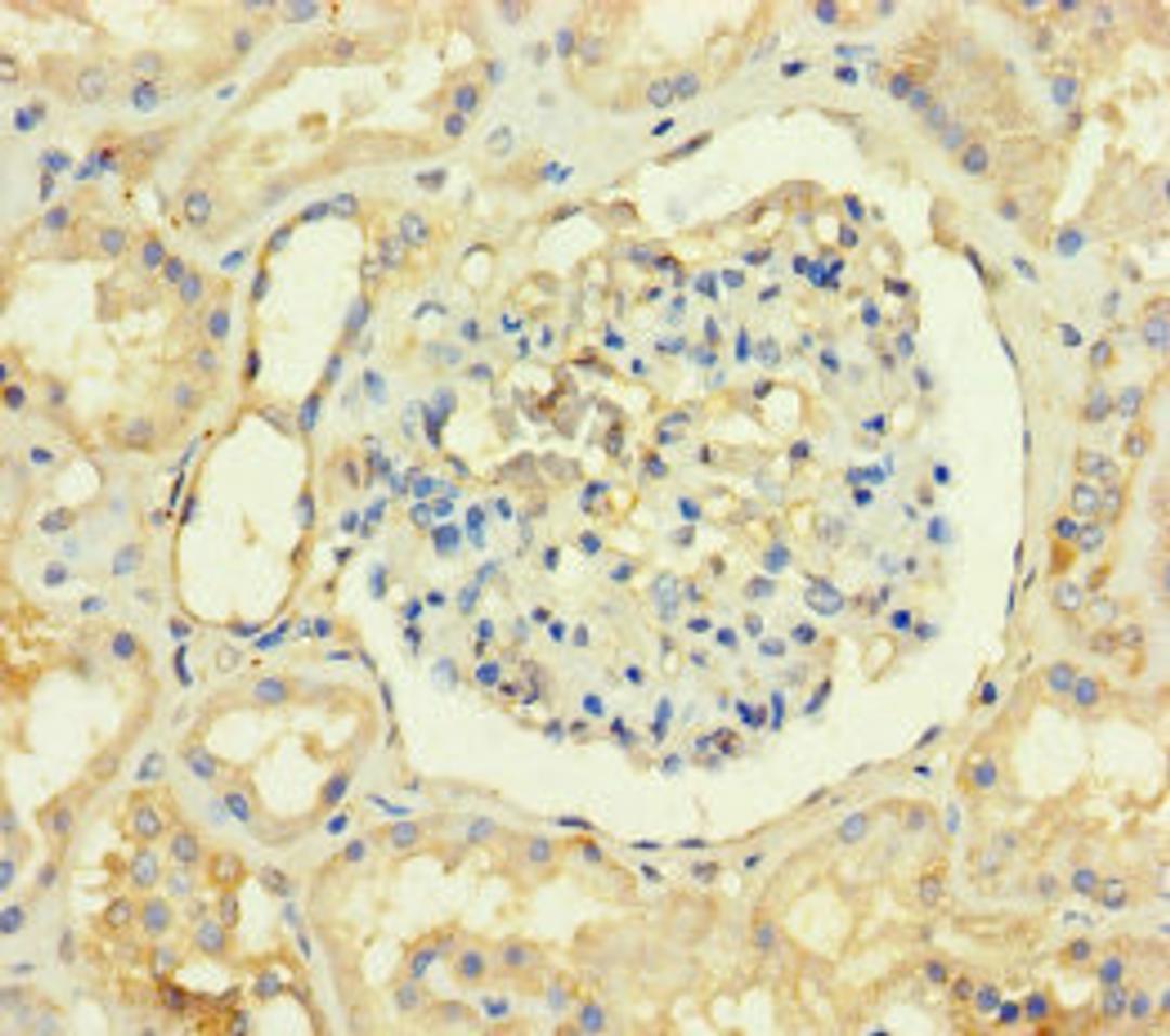 Immunohistochemistry of paraffin-embedded human kidney tissue using CSB-PA023885LA01HU at dilution of 1:100