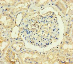 Immunohistochemistry of paraffin-embedded human kidney tissue using CSB-PA023885LA01HU at dilution of 1:100