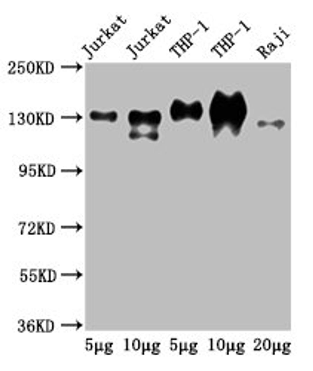 Western Blot. Positive WB detected in: Jurkat whole cell lysate, THP-1 whole cell lysate, Raji whole cell lysate. All lanes: CD31 antibody at 2.5µg/ml. Secondary. Goat polyclonal to Mouse IgG at 1/50000 dilution. Predicted band size: 83, 81, 80, 82 kDa. Observed band size: 130 kDa.