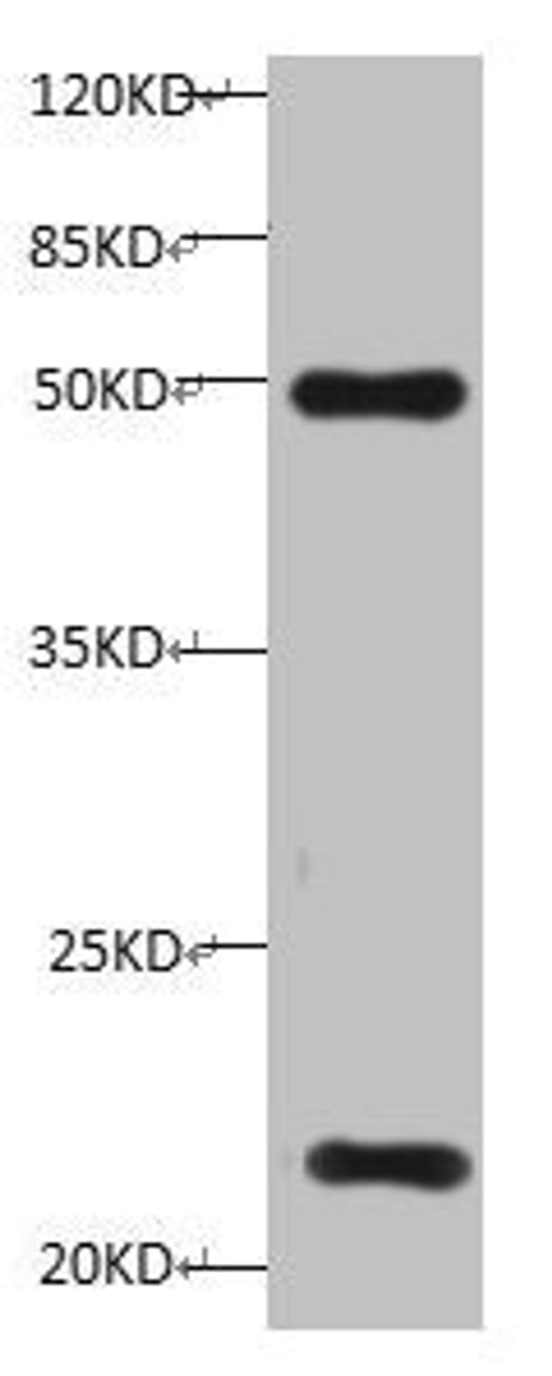 All lanes:Mouse anti-Human Timp1 monoclonal antibody at 1ug/ml. Lane 1: HepG-2 cell lysate. Predicted band size : 23 kDa. Observed band size : 23 kDa. Additional bands at:50KD. 