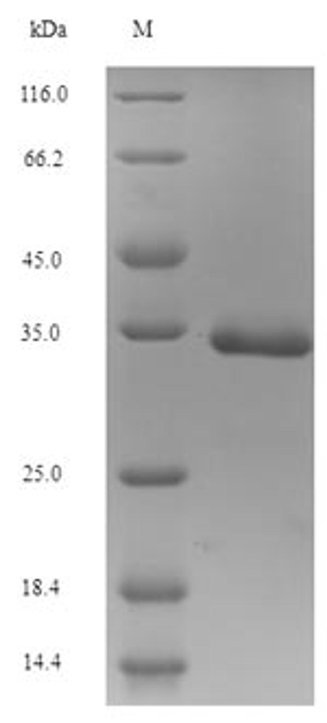 (Tris-Glycine gel) Discontinuous SDS-PAGE (reduced) with 5% enrichment gel and 15% separation gel.