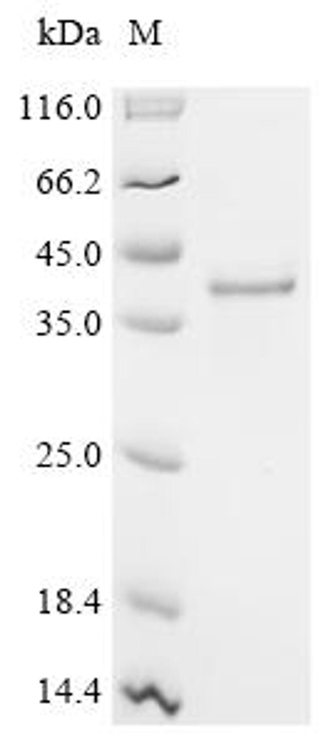 (Tris-Glycine gel) Discontinuous SDS-PAGE (reduced) with 5% enrichment gel and 15% separation gel.