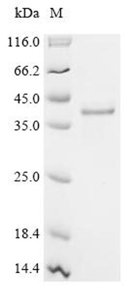 (Tris-Glycine gel) Discontinuous SDS-PAGE (reduced) with 5% enrichment gel and 15% separation gel.
