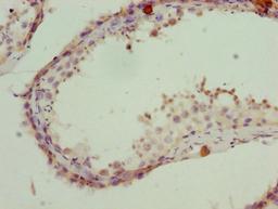 Immunohistochemistry of paraffin-embedded human testis tissue using CSB-PA018899LA01HU at dilution of 1:100