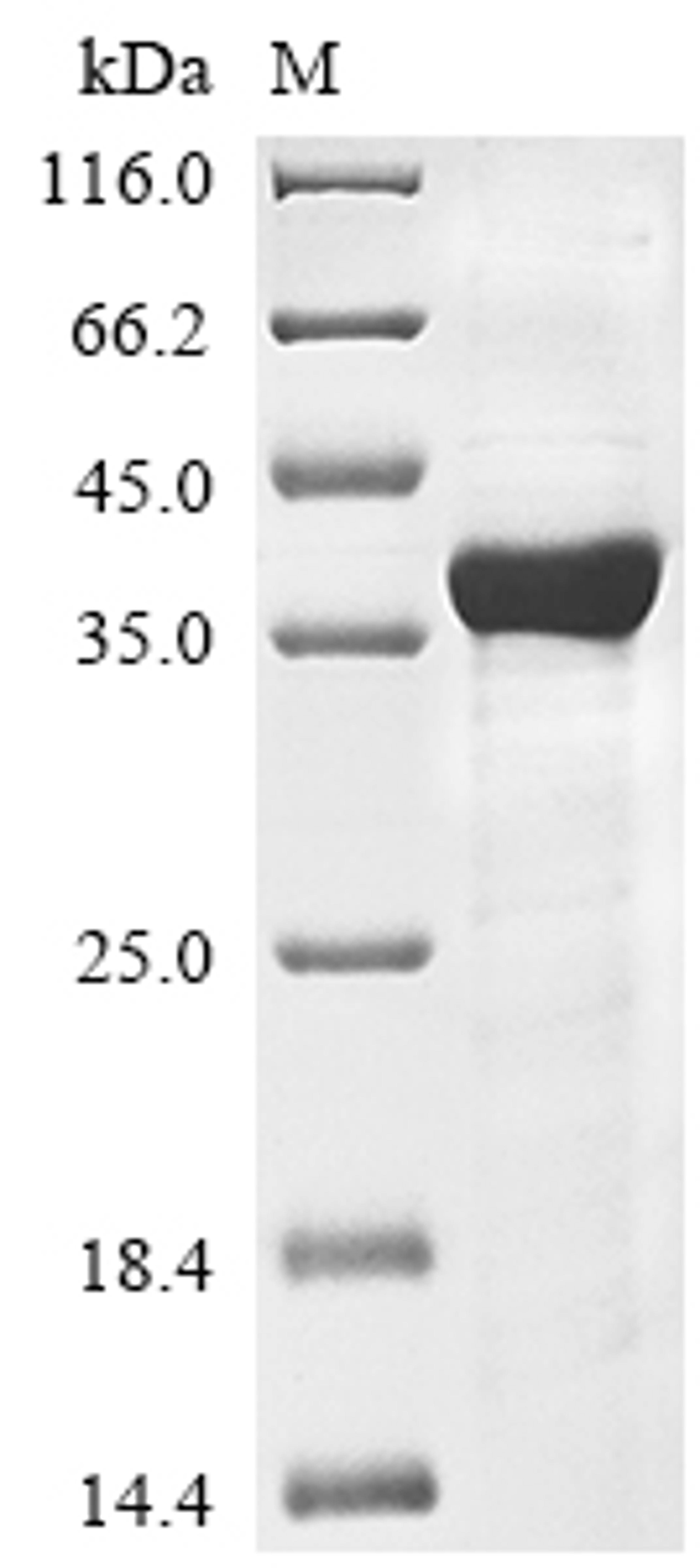 (Tris-Glycine gel) Discontinuous SDS-PAGE (reduced) with 5% enrichment gel and 15% separation gel.