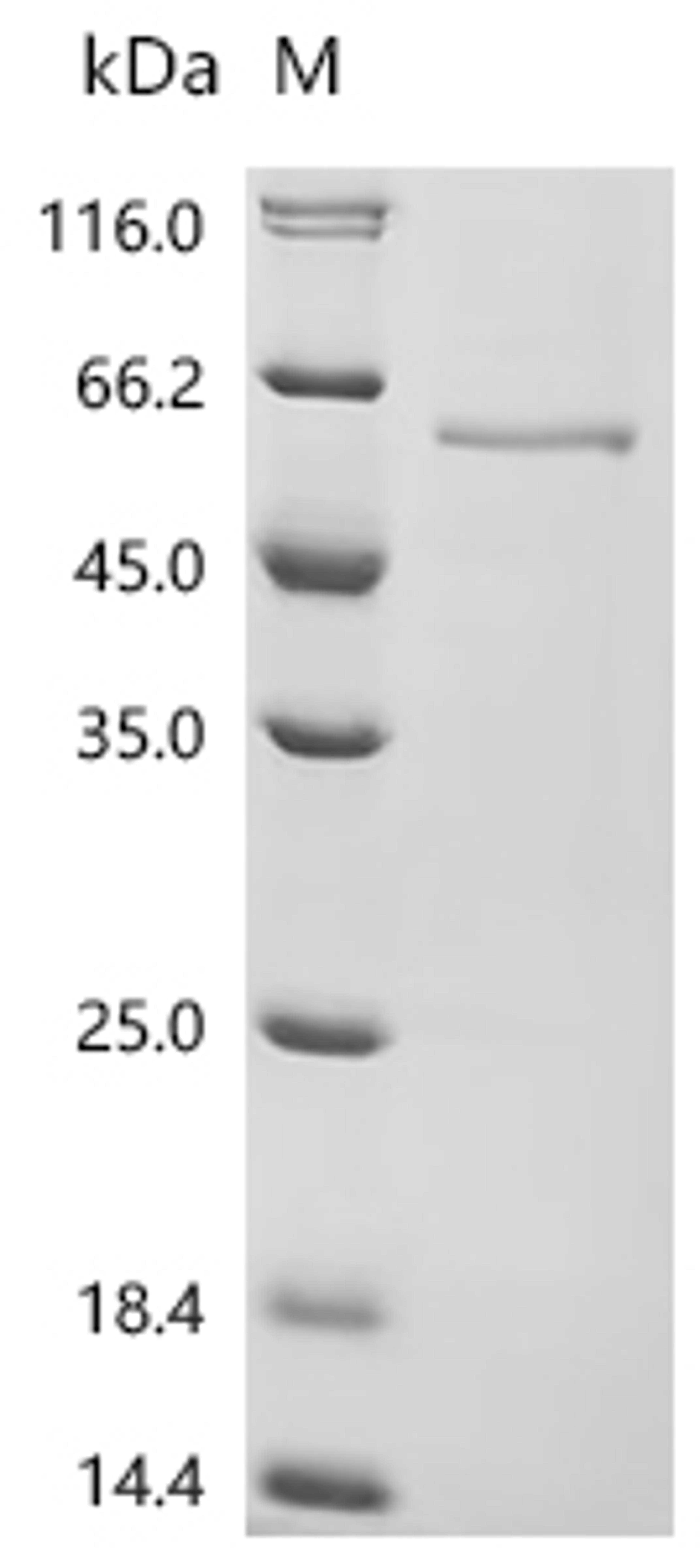 (Tris-Glycine gel) Discontinuous SDS-PAGE (reduced) with 5% enrichment gel and 15% separation gel.