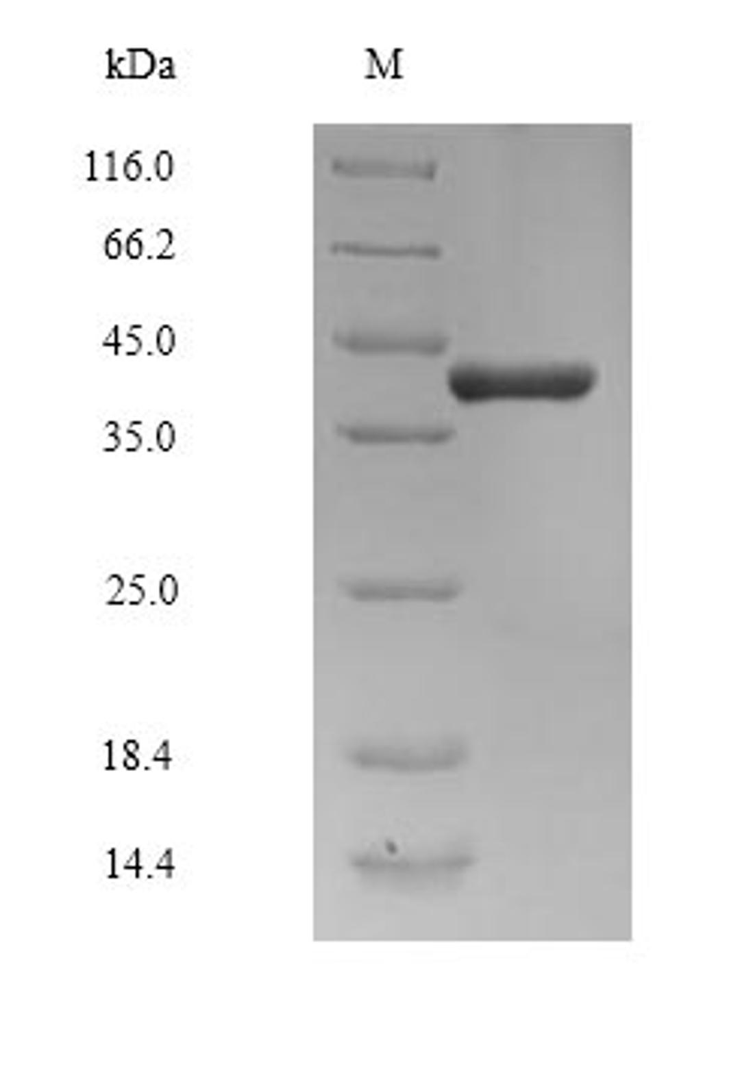 (Tris-Glycine gel) Discontinuous SDS-PAGE (reduced) with 5% enrichment gel and 15% separation gel.