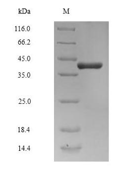 (Tris-Glycine gel) Discontinuous SDS-PAGE (reduced) with 5% enrichment gel and 15% separation gel.
