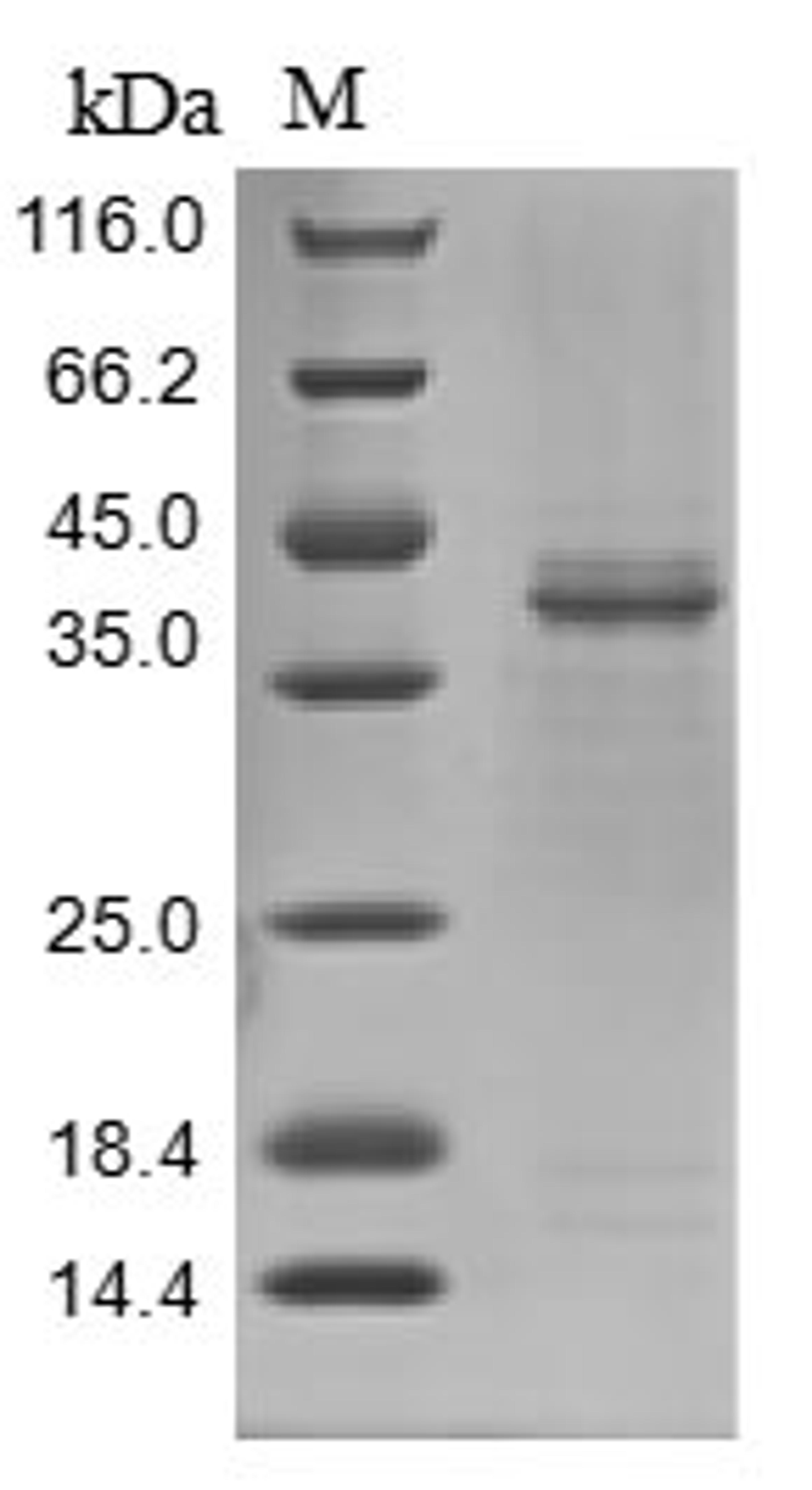 (Tris-Glycine gel) Discontinuous SDS-PAGE (reduced) with 5% enrichment gel and 15% separation gel.
