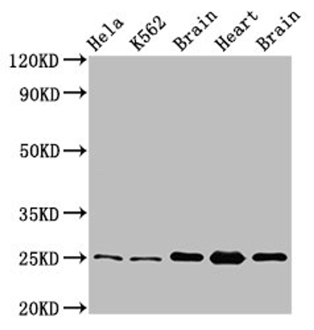 Western Blot. Positive WB detected in: Hela whole cell lysate, K562 whole cell lysate, Rat brain tissue, Rat heart tissue, Mouse brain tissu. All lanes: SOD2 antibody at 3.4µg/ml. Secondary. Goat polyclonal to rabbit IgG at 1/50000 dilution. Predicted band size: 25, 21, 19, 20 kDa. Observed band size: 25 kDa