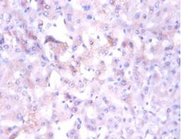 Immunohistochemistry of paraffin-embedded human liver tissue using CSB-PA01665A0Rb at dilution of 1:100