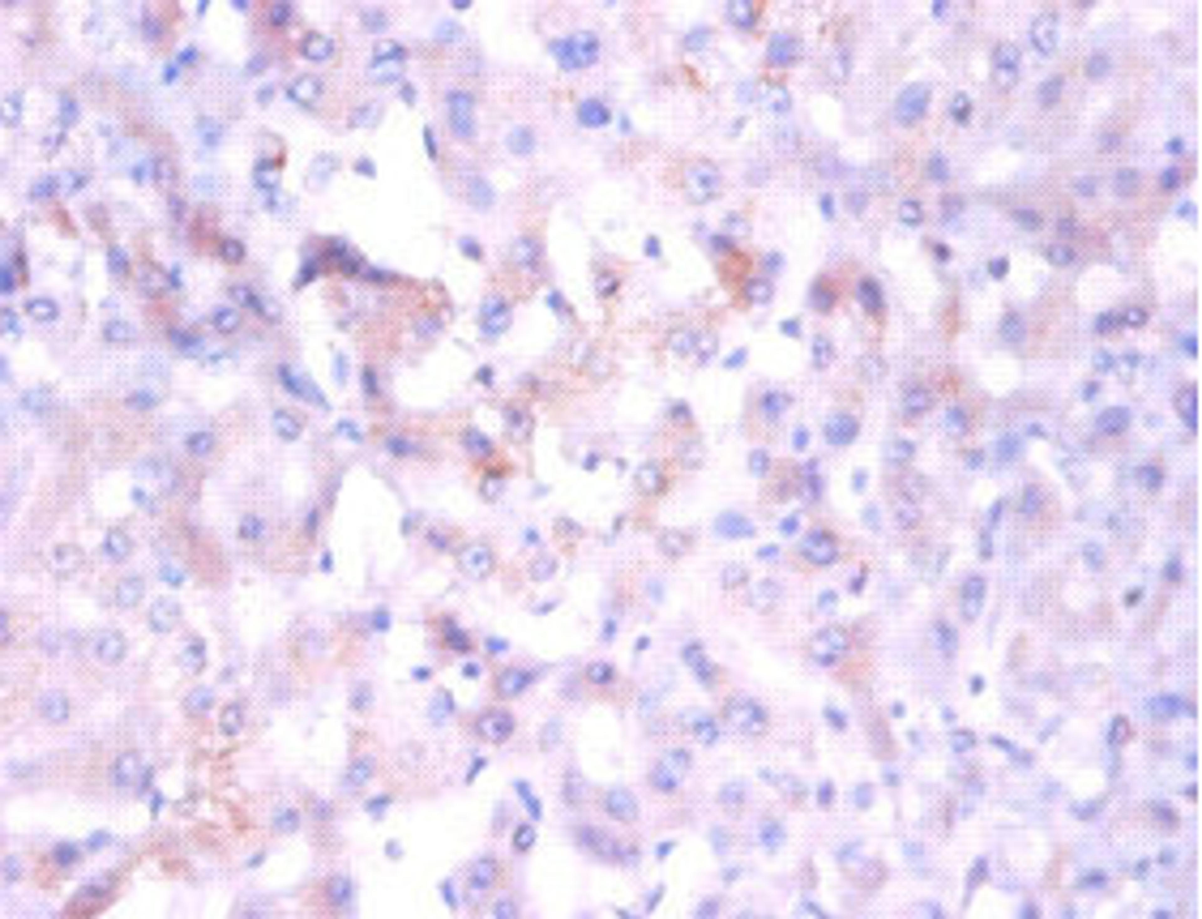 Immunohistochemistry of paraffin-embedded human liver tissue using CSB-PA01665A0Rb at dilution of 1:100