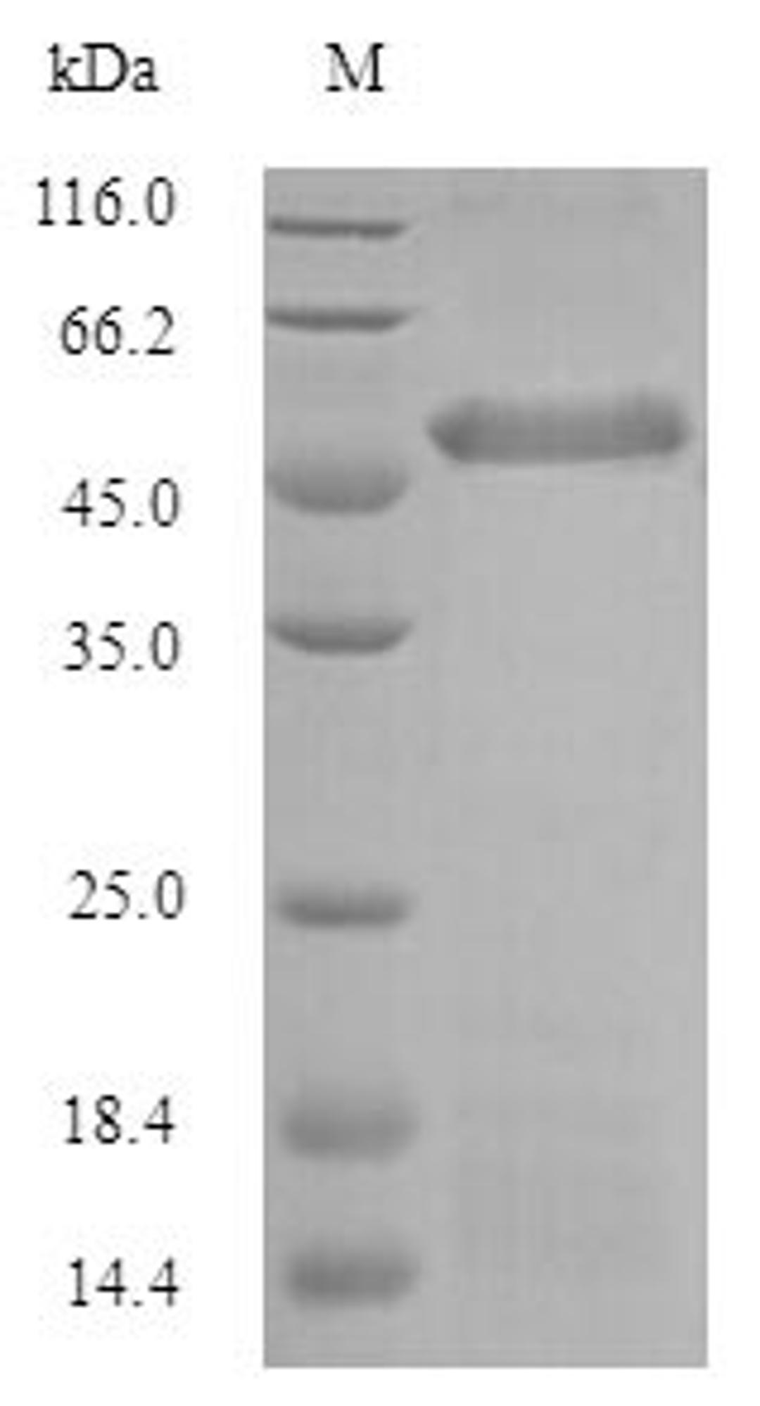 (Tris-Glycine gel) Discontinuous SDS-PAGE (reduced) with 5% enrichment gel and 15% separation gel.