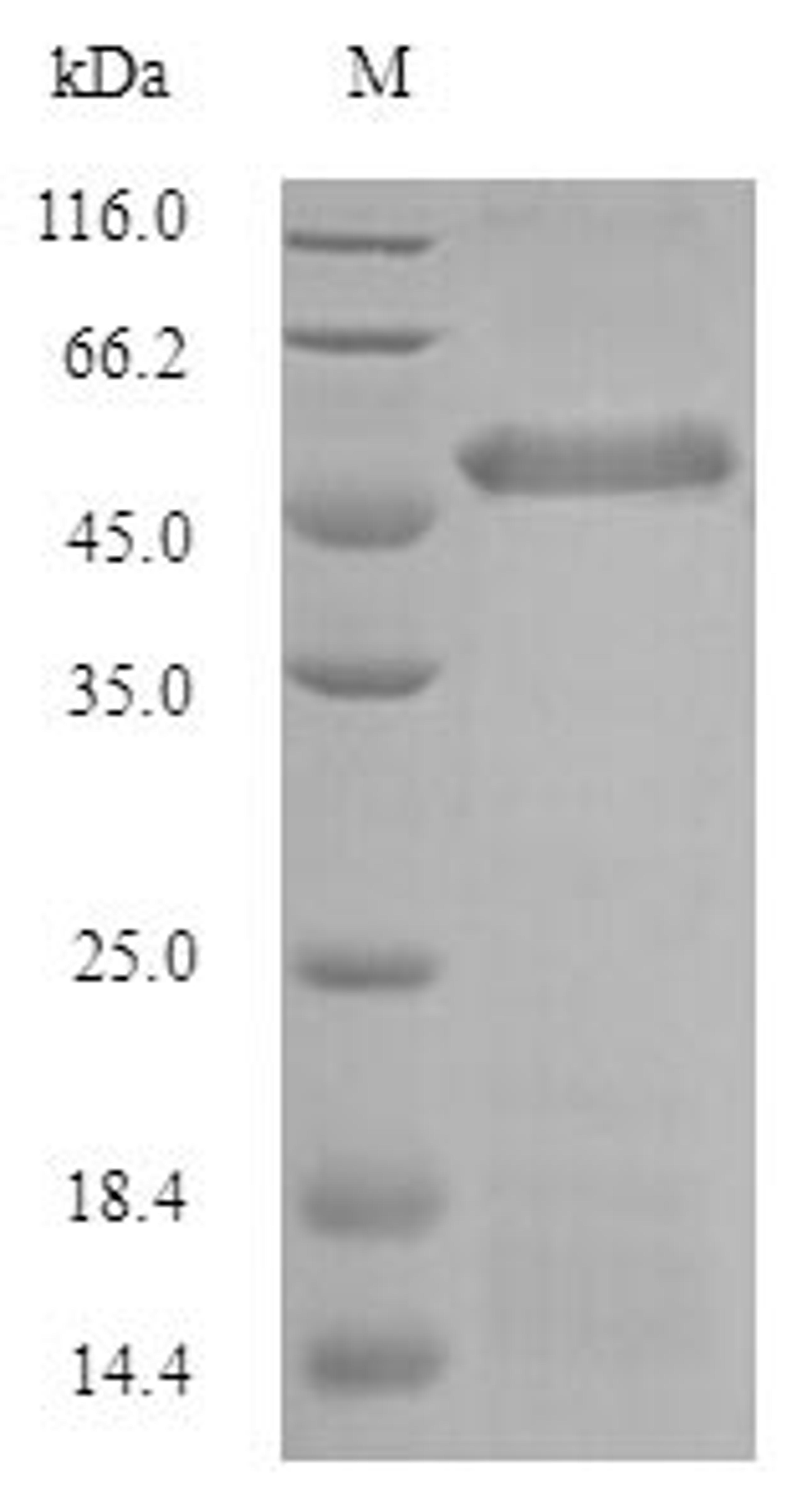(Tris-Glycine gel) Discontinuous SDS-PAGE (reduced) with 5% enrichment gel and 15% separation gel.