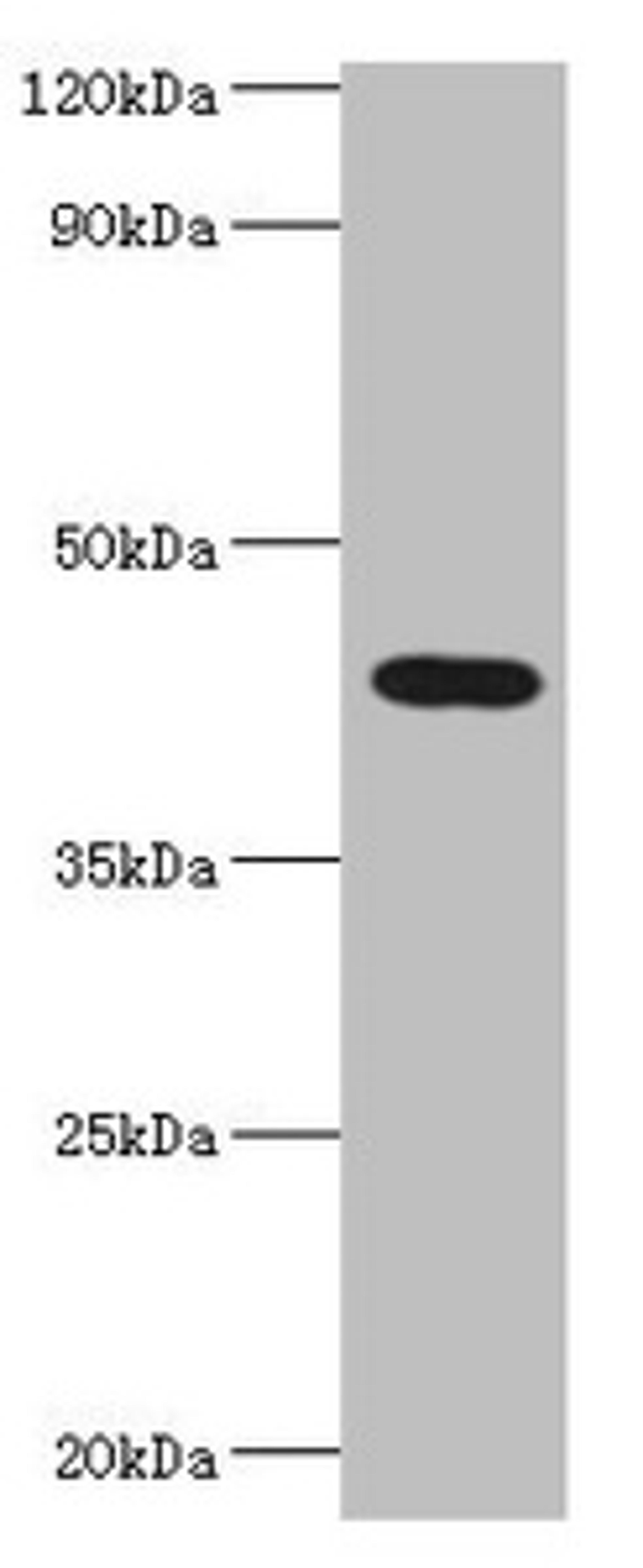 Western blot. All lanes: HAUS augmin-like complex subunit 4 antibody at 6ug/ml + Rat brain tissue. Secondary. Goat polyclonal to rabbit IgG at 1/10000 dilution. Predicted band size: 43, 28, 29, 38 kDa. Observed band size: 43 kDa. 