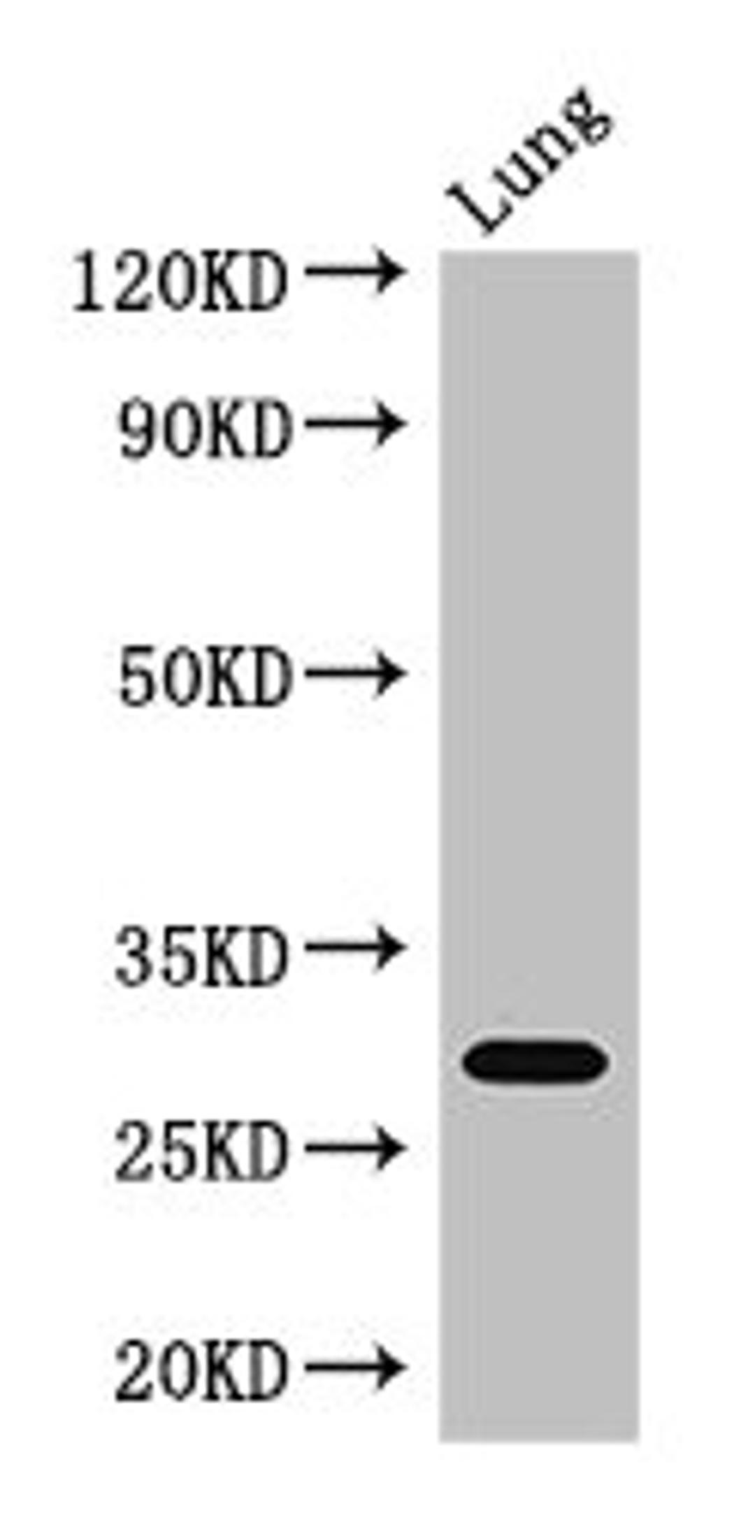 Western Blot. Positive WB detected in: Mouse lung tissue. All lanes: PSMB5 antibody at 3ug/ml. Secondary. Goat polyclonal to rabbit IgG at 1/50000 dilution. Predicted band size: 29, 22, 18 kDa. Observed band size: 29 kDa. 