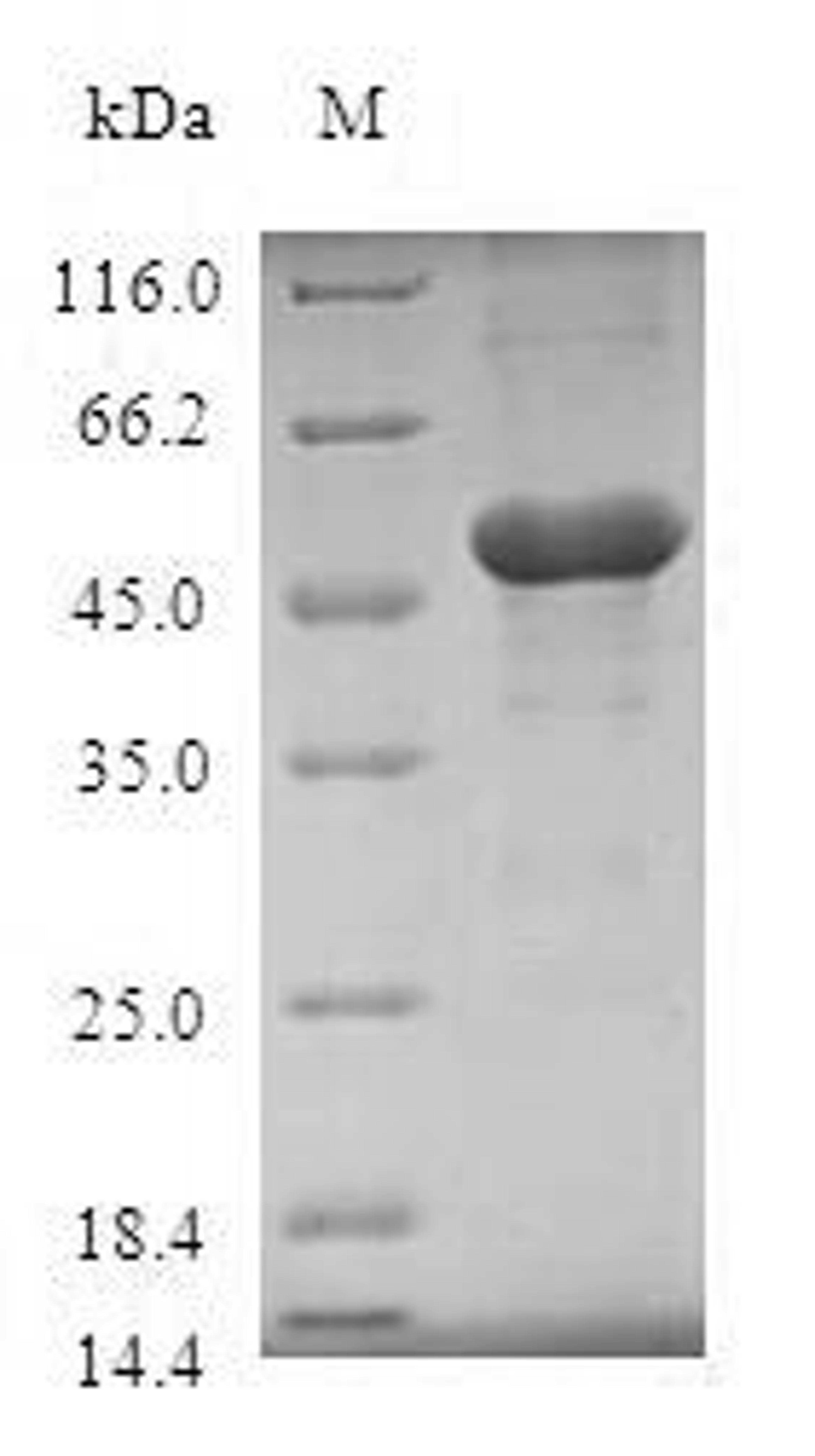 (Tris-Glycine gel) Discontinuous SDS-PAGE (reduced) with 5% enrichment gel and 15% separation gel.