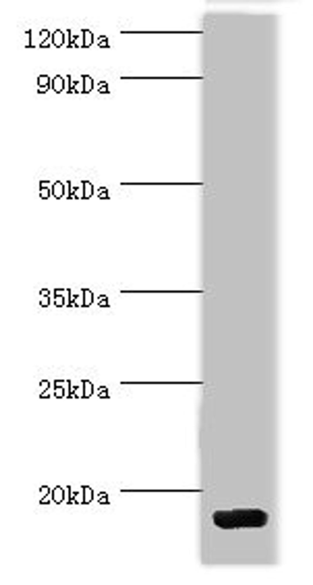 Western blot. All lanes: C-C motif chemokine 28 antibody at 5ug/ml + Mouse spleen tissue. Secondary. Goat polyclonal to rabbit IgG at 1/10000 dilution. Predicted band size: 15, 13 kDa. Observed band size: 15 kDa. 