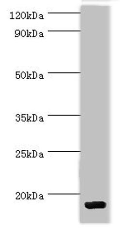 Western blot. All lanes: C-C motif chemokine 28 antibody at 5ug/ml + Mouse spleen tissue. Secondary. Goat polyclonal to rabbit IgG at 1/10000 dilution. Predicted band size: 15, 13 kDa. Observed band size: 15 kDa. 