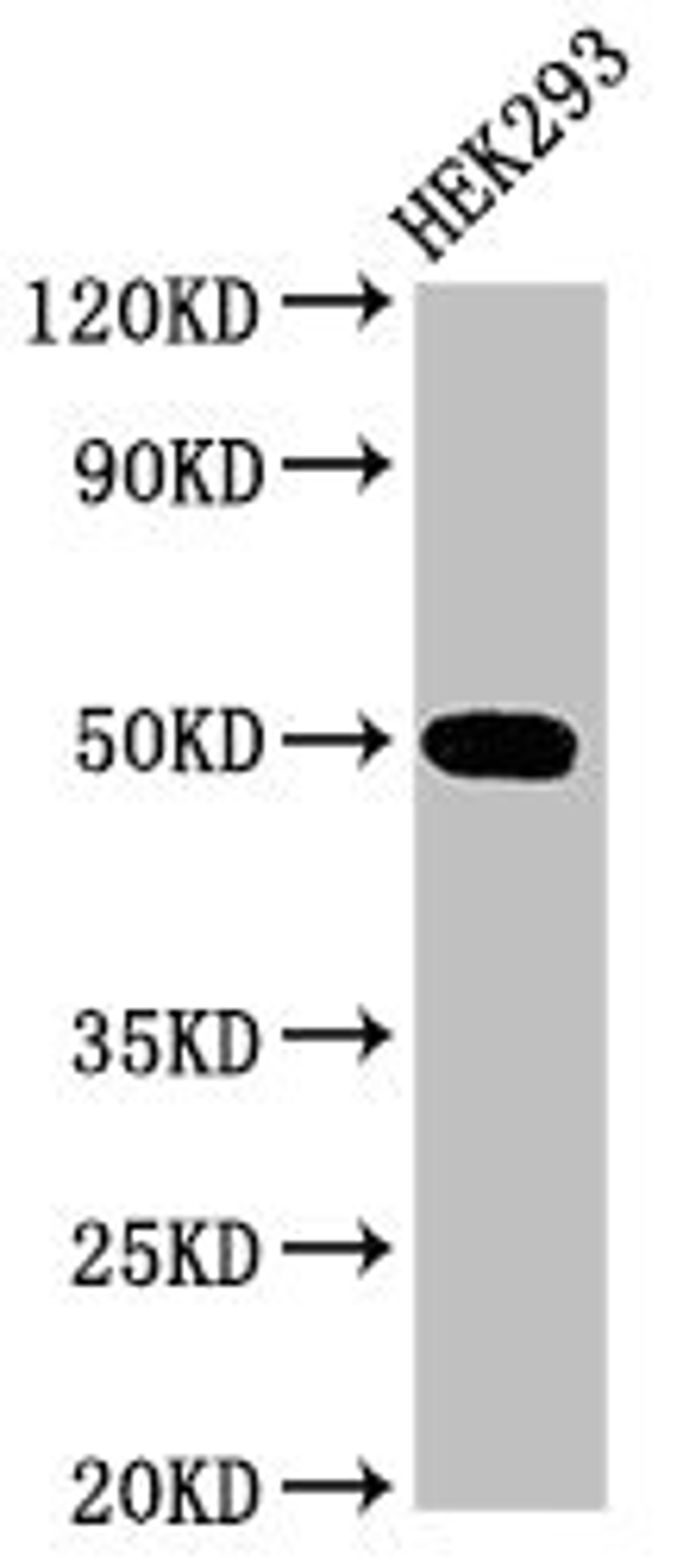 Western Blot. Positive WB detected in: HEK293 whole cell lysate. All lanes: TGFB1I1 antibody at 3.2ug/ml. Secondary. Goat polyclonal to rabbit IgG at 1/50000 dilution. Predicted band size: 50, 48 kDa. Observed band size: 50 kDa. 