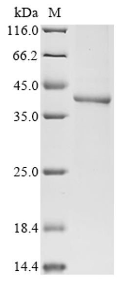 (Tris-Glycine gel) Discontinuous SDS-PAGE (reduced) with 5% enrichment gel and 15% separation gel.