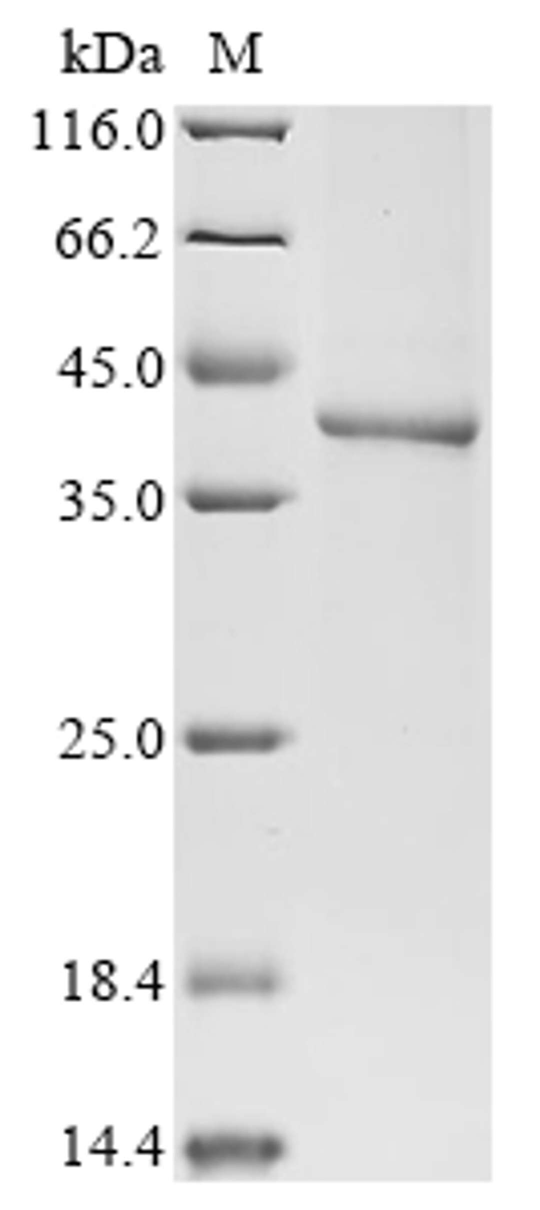 (Tris-Glycine gel) Discontinuous SDS-PAGE (reduced) with 5% enrichment gel and 15% separation gel.