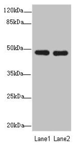 Western blot. All lanes: GCM1antibody at 0.97ug/ml. Lane 1: Hela whole cell lysate. Lane 2: HepG2 whole cell lysate. Secondary. Goat polyclonal to rabbit IgG at 1/10000 dilution. Predicted band size: 49 kDa. Observed band size: 49 kDa. 