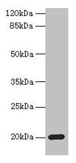 Western blot. All lanes: MPV17 antibody at 2µg/ml + Mouse heart tissue. Secondary. Goat polyclonal to rabbit IgG at 1/10000 dilution. Predicted band size: 20 kDa. Observed band size: 20 kDa