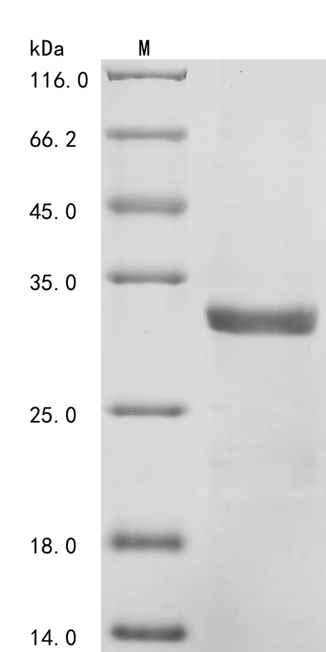 (Tris-Glycine gel) Discontinuous SDS-PAGE (reduced) with 5% enrichment gel and 15% separation gel.