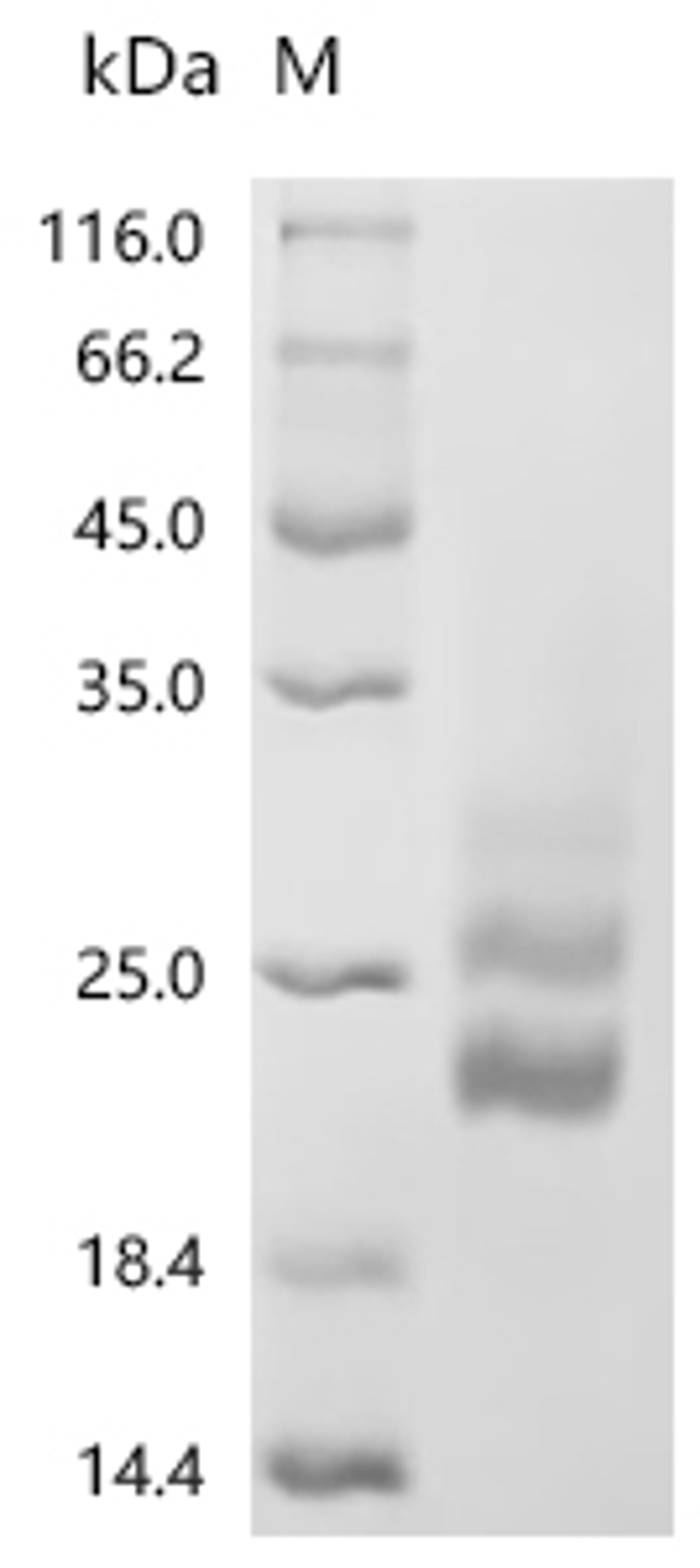 (Tris-Glycine gel) Discontinuous SDS-PAGE (reduced) with 5% enrichment gel and 15% separation gel.