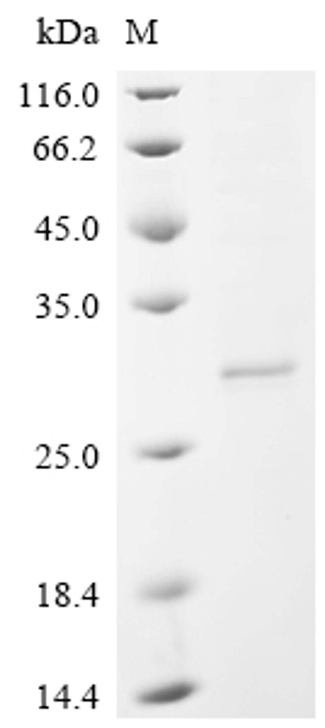 (Tris-Glycine gel) Discontinuous SDS-PAGE (reduced) with 5% enrichment gel and 15% separation gel.