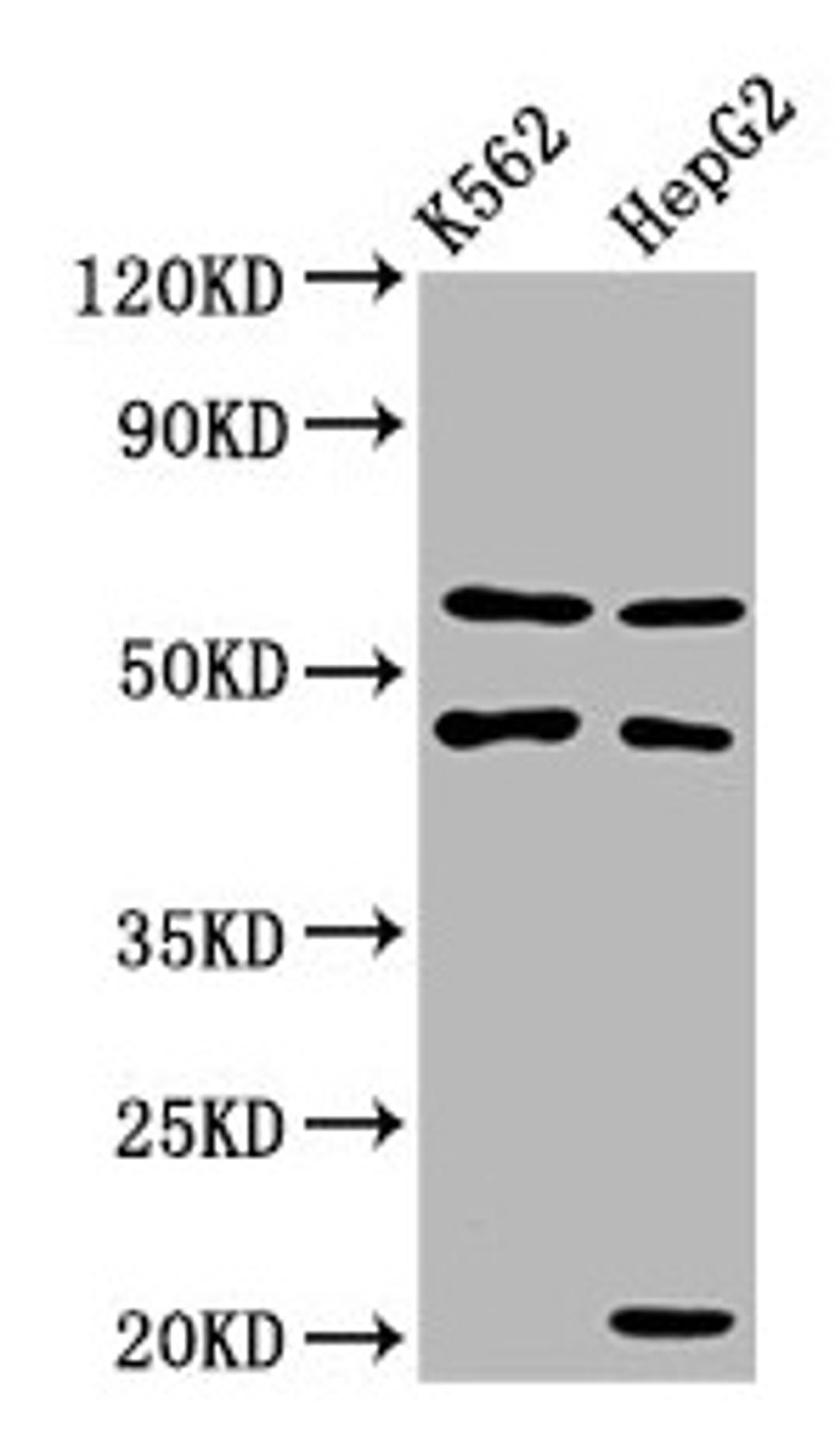 Western Blot. Positive WB detected in: K562 whole cell lysate, HepG2 whole cell lysate. All lanes: GATB antibody at 3.4µg/ml. Secondary. Goat polyclonal to rabbit IgG at 1/50000 dilution. Predicted band size: 62 kDa. Observed band size: 62 kDa