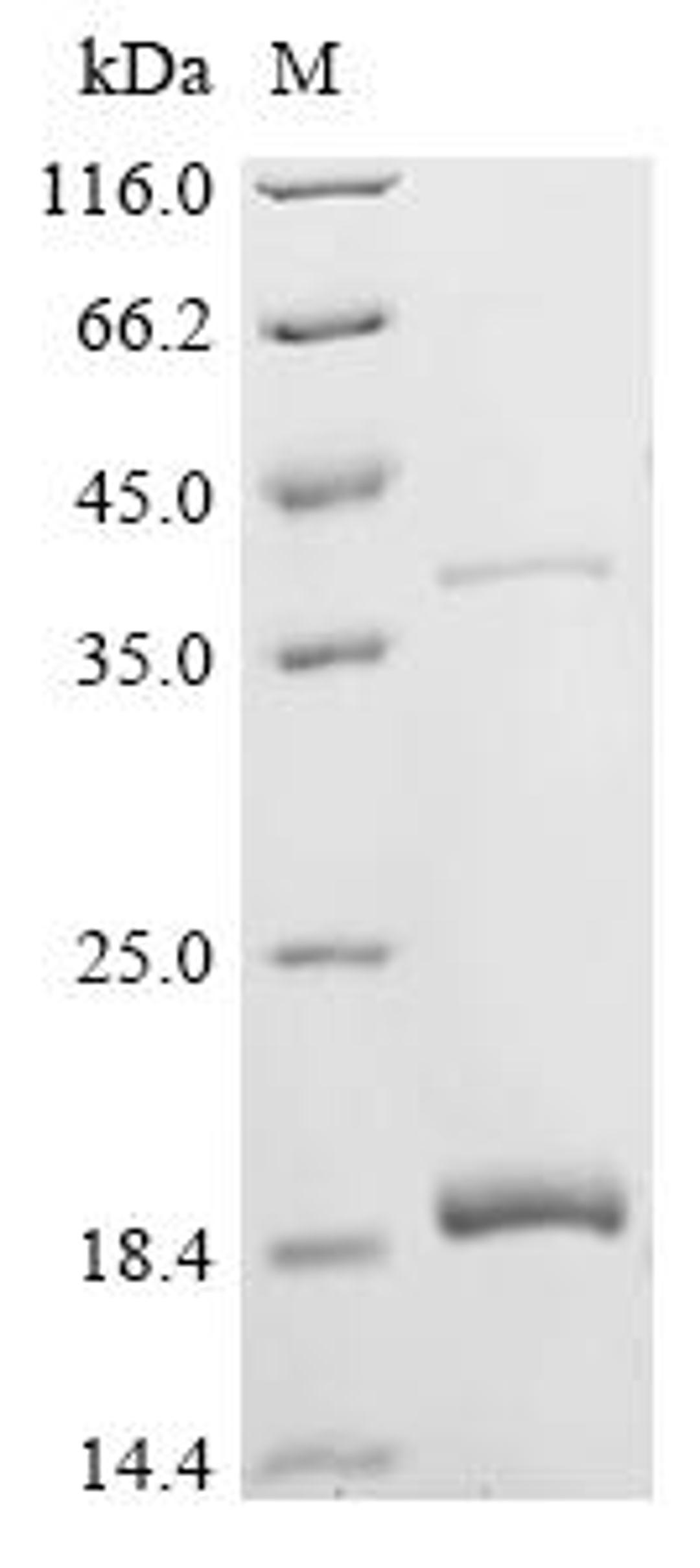(Tris-Glycine gel) Discontinuous SDS-PAGE (reduced) with 5% enrichment gel and 15% separation gel.