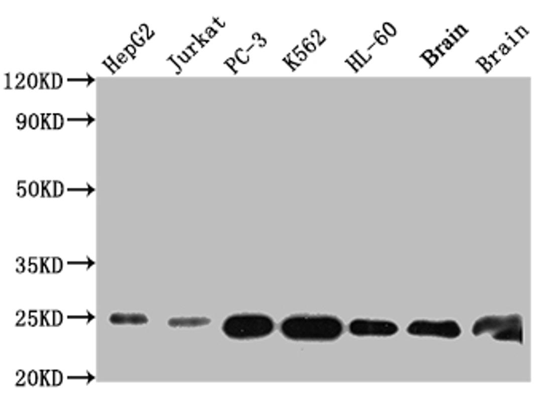 Western Blot. Positive WB detected in: HepG2 whole cell lysate, Jurkat whole cell lysate, PC-3 whole cell lysate, K562 whole cell lysate, HL-60 whole cell lysate, Mouse Brain whole cell lysate, Rat Brain whole cell lysate. All lanes: GSTP1 antibody at 1:1000. Secondary. Goat polyclonal to rabbit IgG at 1/50000 dilution. Predicted band size: 24 kDa. Observed band size: 24 kDa. 