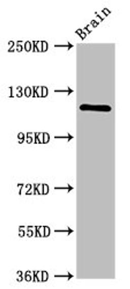 Western Blot. Positive WB detected in: Rat brain tissue. All lanes: HIP1R antibody at 2.4ug/ml. Secondary. Goat polyclonal to rabbit IgG at 1/50000 dilution. Predicted band size: 120, 71 kDa. Observed band size: 120 kDa. 