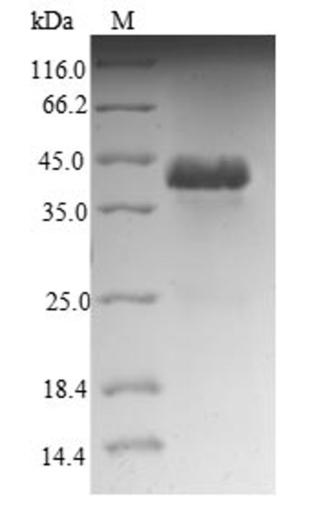 (Tris-Glycine gel) Discontinuous SDS-PAGE (reduced) with 5% enrichment gel and 15% separation gel.