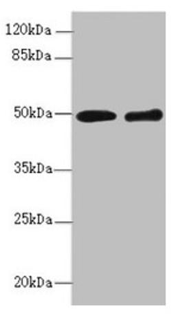 Western blot. All lanes: ZBTB25 antibody at 1.41µg/ml. Lane 1: MCF-7 whole cell lysate. Lane 2: Hela whole cell lysate. Secondary. Goat polyclonal to rabbit IgG at 1/10000 dilution. Predicted band size: 49 kDa. Observed band size: 49 kDa