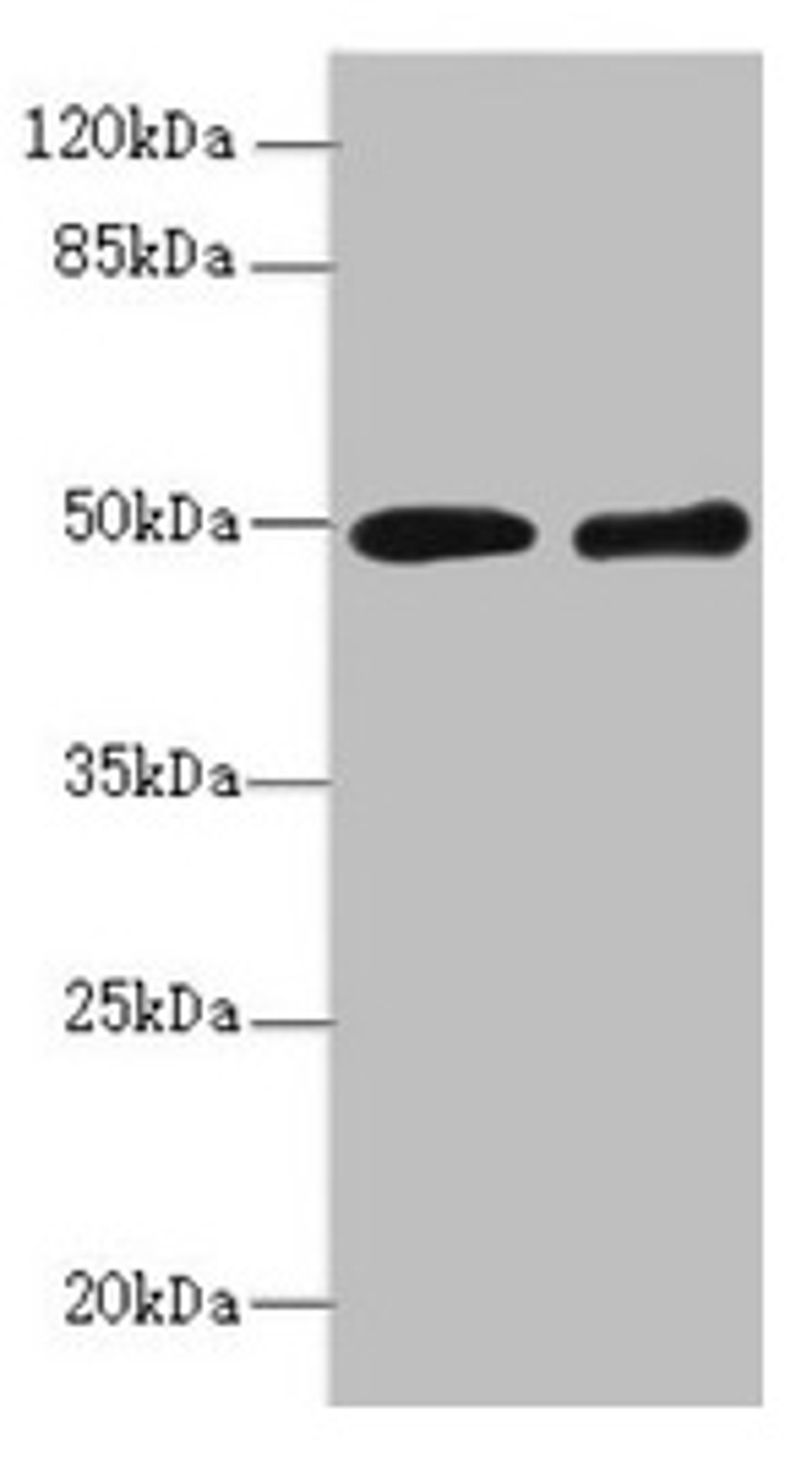 Western blot. All lanes: ZBTB25 antibody at 1.41µg/ml. Lane 1: MCF-7 whole cell lysate. Lane 2: Hela whole cell lysate. Secondary. Goat polyclonal to rabbit IgG at 1/10000 dilution. Predicted band size: 49 kDa. Observed band size: 49 kDa
