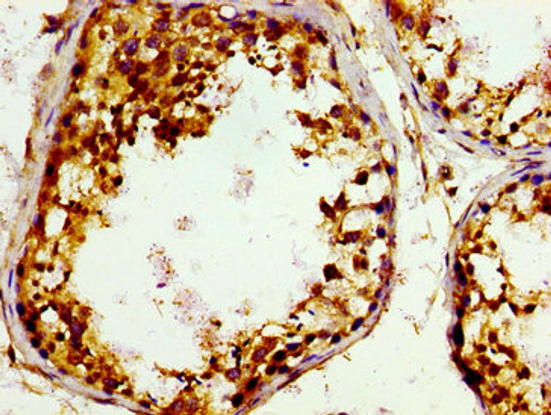 Immunohistochemistry of paraffin-embedded human testis tissue using CSB-PA009190LA01HU at dilution of 1:100