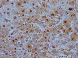 IHC image of CSB-MA908650 diluted at 1:100 and staining in paraffin-embedded human liver tissue performed on a Leica BondTM system. After dewaxing and hydration, antigen retrieval was mediated by high pressure in a citrate buffer (pH 6.0). Section was blocked with 10% normal goat serum 30min at RT. Then primary antibody (1% BSA) was incubated at 4°C overnight. The primary is detected by a Goat anti-mouse IgG polymer labeled by HRP and visualized using 0.05% DAB.
