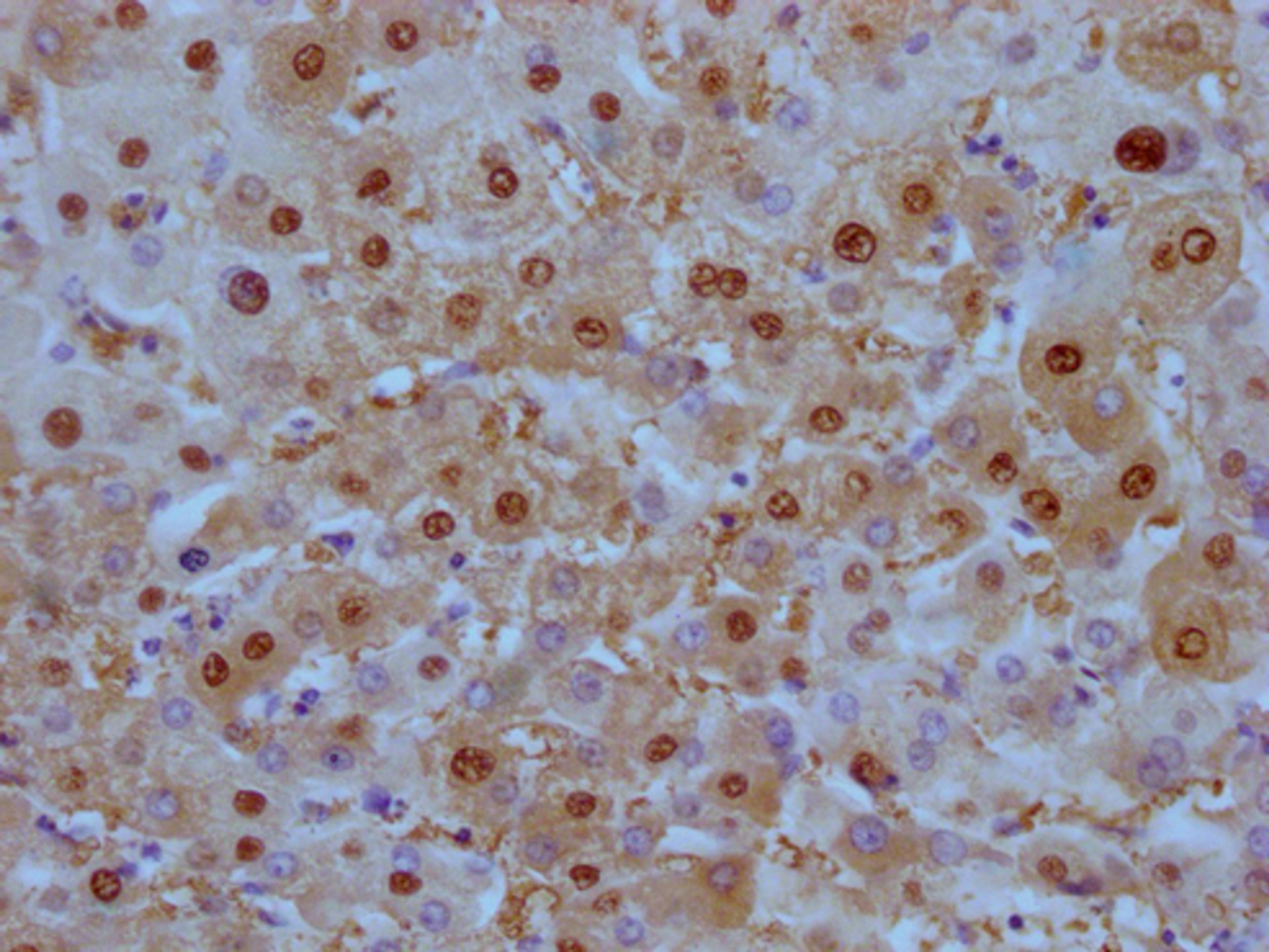 IHC image of CSB-MA908650 diluted at 1:100 and staining in paraffin-embedded human liver tissue performed on a Leica BondTM system. After dewaxing and hydration, antigen retrieval was mediated by high pressure in a citrate buffer (pH 6.0). Section was blocked with 10% normal goat serum 30min at RT. Then primary antibody (1% BSA) was incubated at 4°C overnight. The primary is detected by a Goat anti-mouse IgG polymer labeled by HRP and visualized using 0.05% DAB.