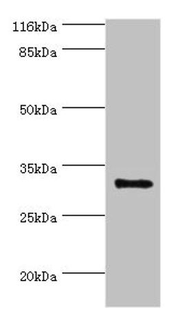 Western blot. All lanes: KLK5 antibody at 2ug/ml + MCF-7 whole cell lysate. Secondary. Goat polyclonal to rabbit IgG at 1/10000 dilution. Predicted band size: 32 kDa. Observed band size: 32 kDa. 