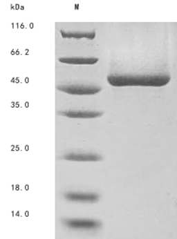 (Tris-Glycine gel) Discontinuous SDS-PAGE (reduced) with 5% enrichment gel and 15% separation gel.