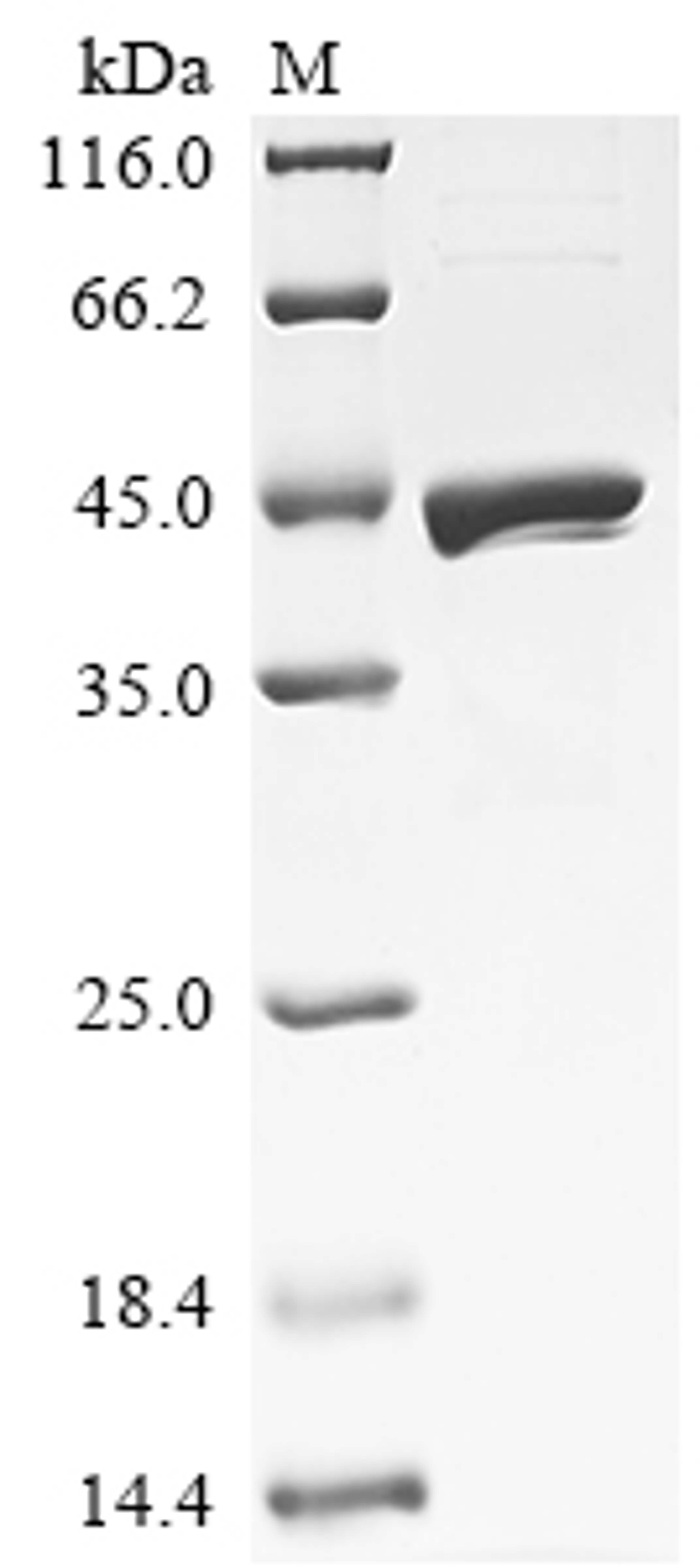 (Tris-Glycine gel) Discontinuous SDS-PAGE (reduced) with 5% enrichment gel and 15% separation gel.