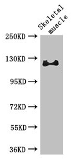 Western Blot. Positive WB detected in: Mouse skeletal muscle tissue. All lanes: RBL1 antibody at 3µg/ml. Secondary. Goat polyclonal to rabbit IgG at 1/50000 dilution. Predicted band size: 121, 115 kDa. Observed band size: 121 kDa