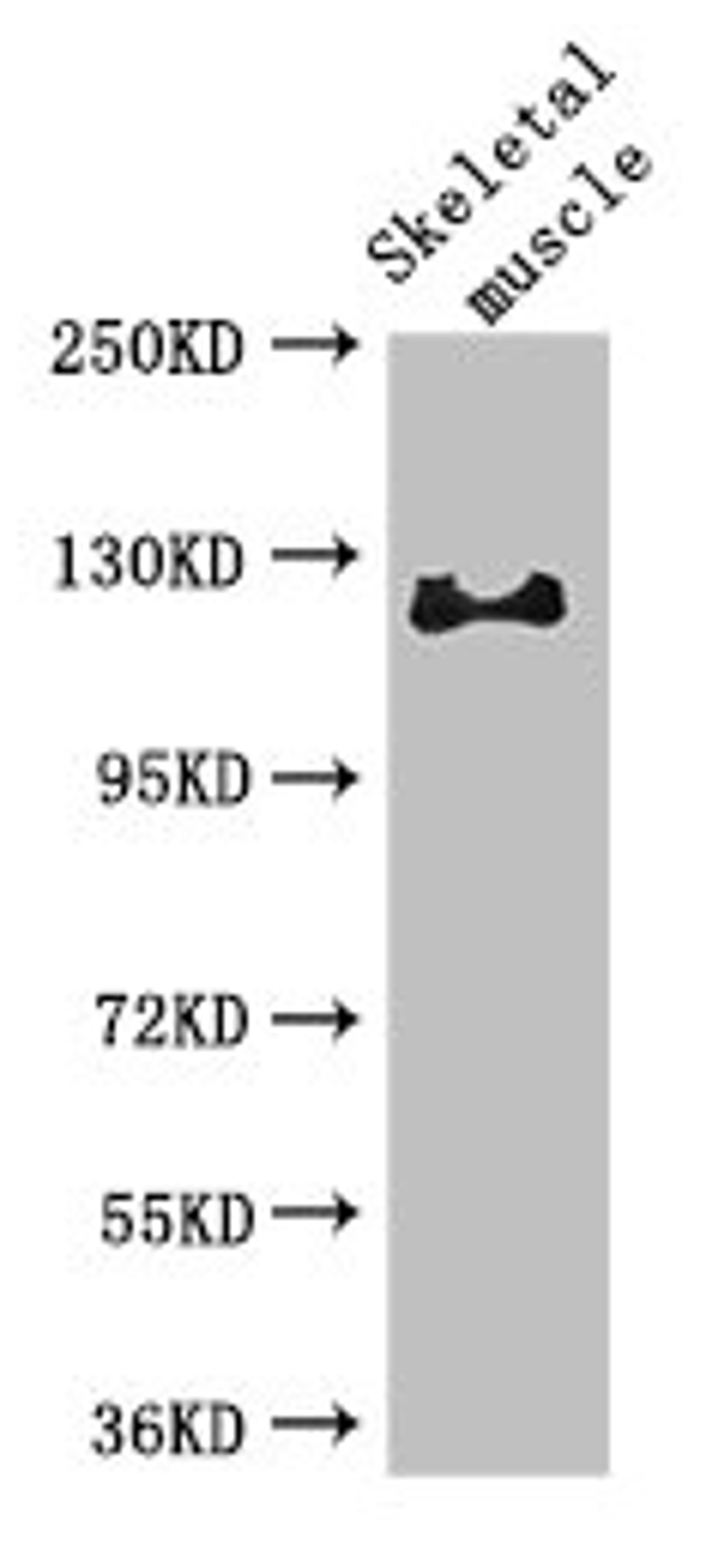 Western Blot. Positive WB detected in: Mouse skeletal muscle tissue. All lanes: RBL1 antibody at 3µg/ml. Secondary. Goat polyclonal to rabbit IgG at 1/50000 dilution. Predicted band size: 121, 115 kDa. Observed band size: 121 kDa