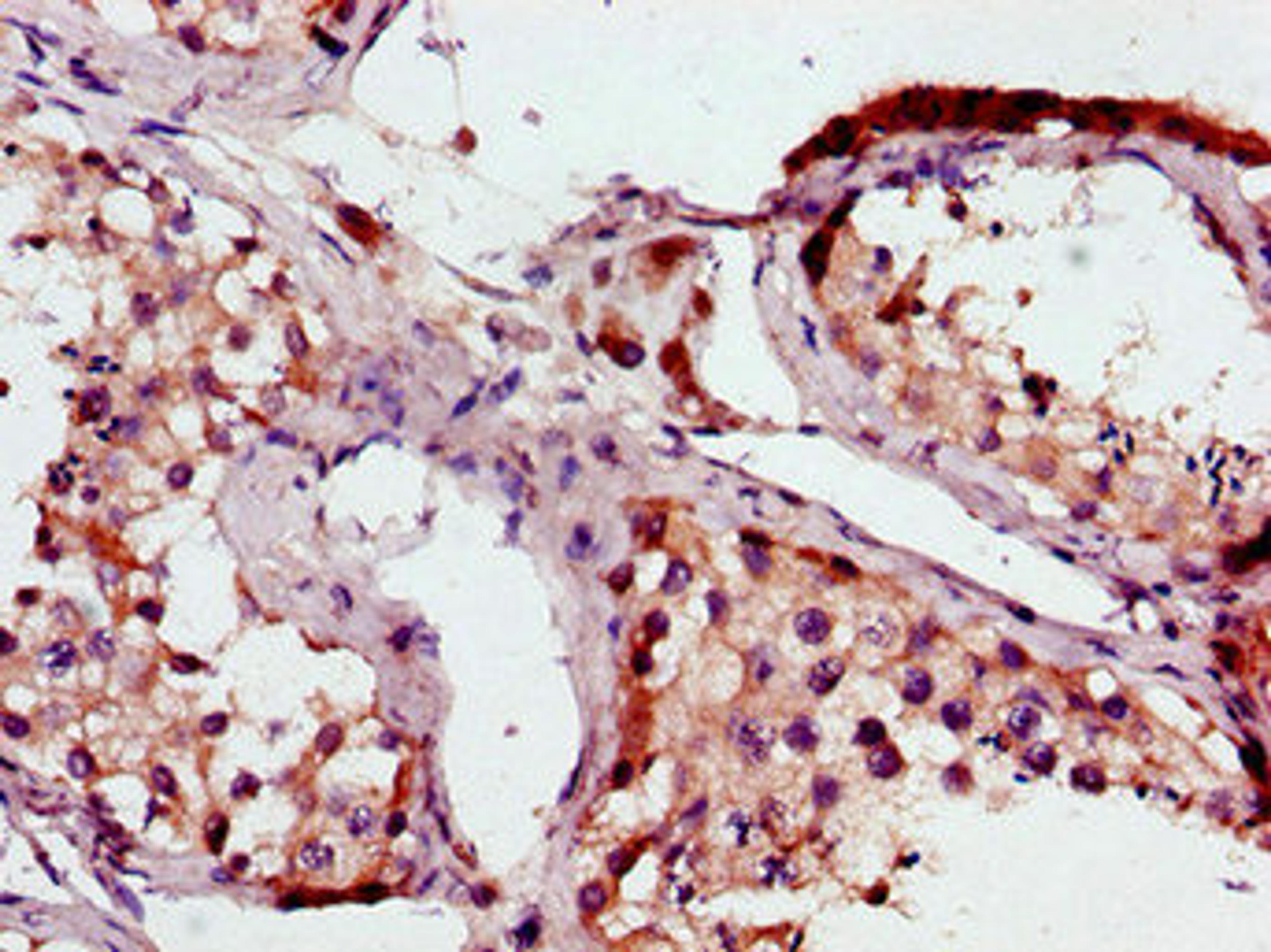 Immunohistochemistry of paraffin-embedded human testis tissue using CSB-PA002791LA01HU at dilution of 1:100